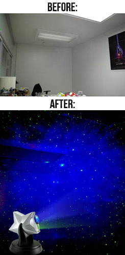 Laser Stars Before And After Shots